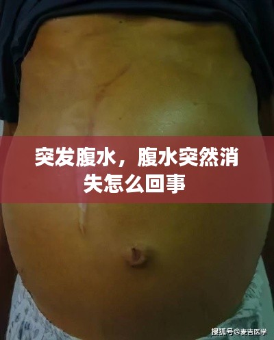 突發(fā)腹水，腹水突然消失怎么回事 