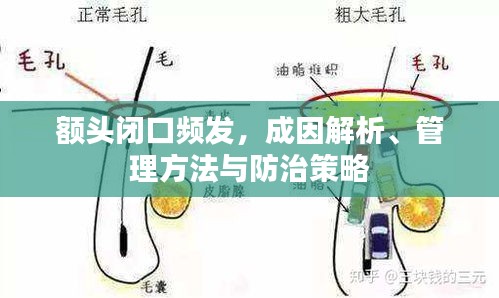額頭閉口頻發(fā)，成因解析、管理方法與防治策略